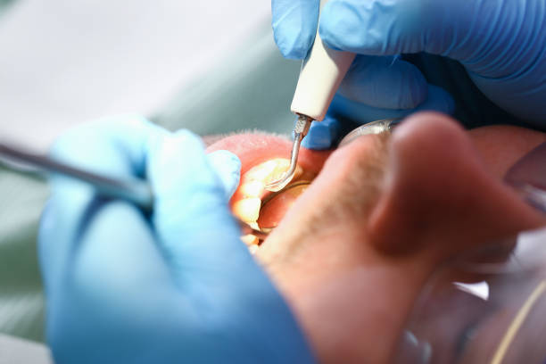Best Emergency Denture Repair in Kahoka, MO