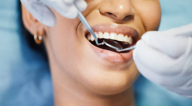 Best Emergency Wisdom Teeth Removal in Kahoka, MO