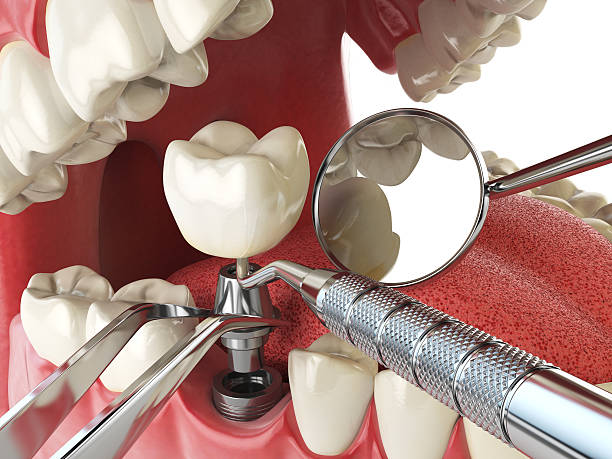 Best Emergency Orthodontic Services in Kahoka, MO