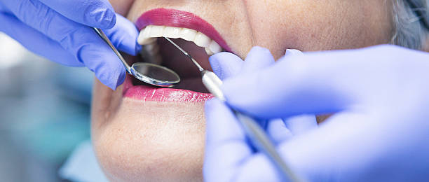 Best Cosmetic Emergency Dentistry in Kahoka, MO