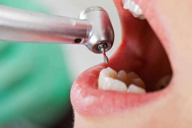 Best Emergency TMJ Treatment in Kahoka, MO